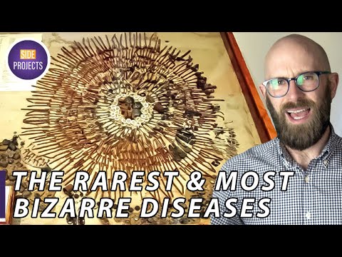 Some of the World's Rarest and Most Bizarre Diseases