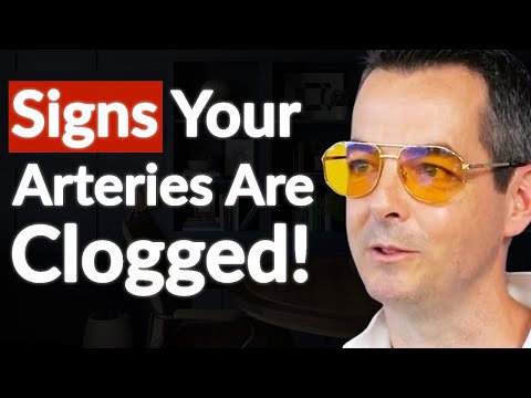 "This Causes Heart Attacks!" - Diet & Lifestyle Habits To Clean Out Your Arteries For Longevity