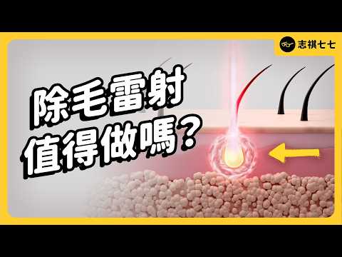 雷射鬍子會痛嗎?後悔還會長出來嗎?遇過最荒謬的客人?|志祺七七