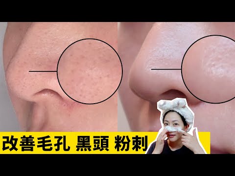 黑頭粉刺byebye!美容師教你超快速溫和毛孔清潔