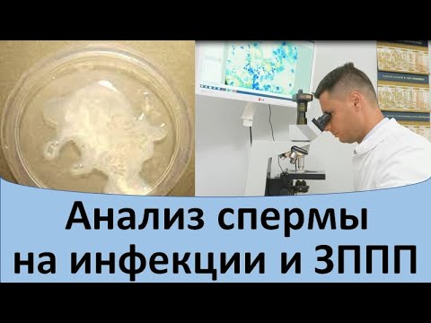 Анализ спермы на ИППП.