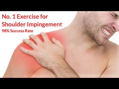 No 1 Shoulder Impingement Exercises (98% Success Rate!) | FREE Exercise Worksheet!