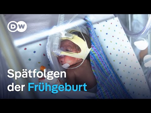 Früh geboren, für immer spät dran? | DW Reporter