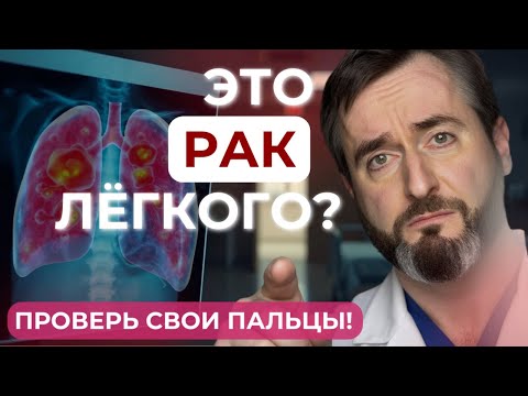 5 Signs of Lung Cancer That Are Easy to Miss!