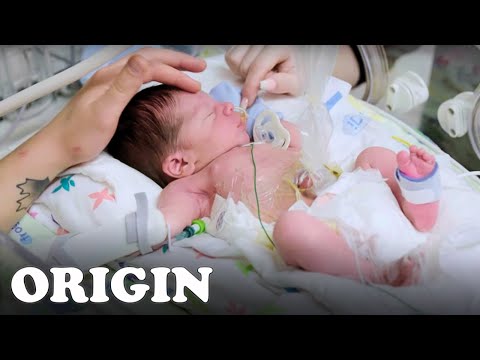 This 2 Day Old Baby Is Beginning It's Life In Intensive Care | Children's Hospital | Full Episode