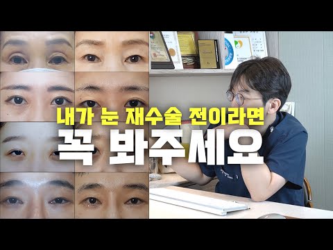 재수술 전 이 영상이 도움이 되었으면 합니다(온라인 성형 상담)