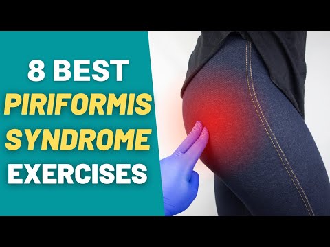 Piriformis Syndrome | 8 BEST Exercises & Stretches