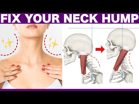 How to Fix a Neck Hump and Slim Face✨Can be done while sitting