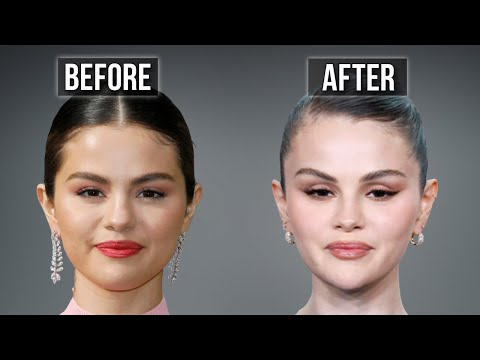 Selena Gomez’s Plastic Surgery Tells a Story… and It’s Not What You Think 