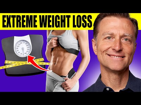 The Ultimate Fat Burning Guide: Dr. Berg's Webinar on Maximum Weight Loss