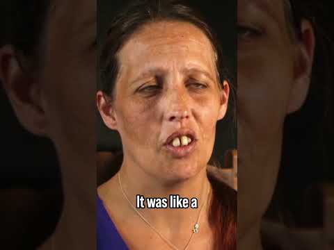 We Went on Holiday… Then Got This Call | Nightmare Neighbour Next Door #news #crime #neighbourwars