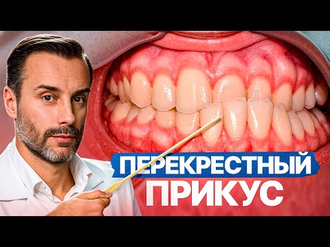 Этот неправильный ПРИКУС разрушает вашу жизнь.. Но 99% людей его даже не замечают!