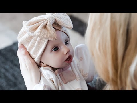 Baby Born with Rare Syndrome That Doesn’t Allow Her To Close Her Eyes