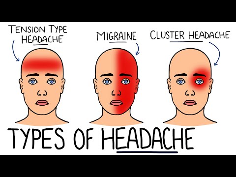 Primary v Secondary Headache (with Red Flags) | Tension Type Headache, Migraine & Cluster Headache