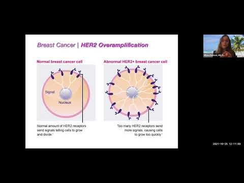 HER2 Positive Breast Cancer Management
