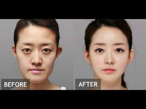 Why is Korea the plastic surgery Capital of the World?