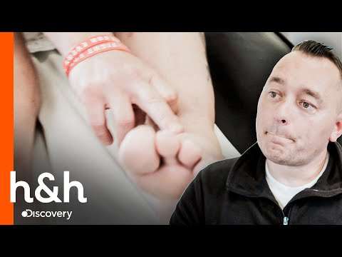 Fue diagnosticado con eritema nodoso | Clínica de la Piel | Discovery H&H