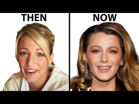 Blake Lively's NEW FACE | Plastic Surgery Analysis
