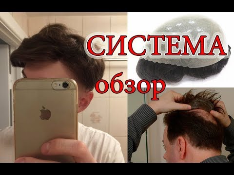 💪Парик-Система замещения волос для мужчин👨 накладка на лысину. Обзор: парик с алиэкспресс мужской