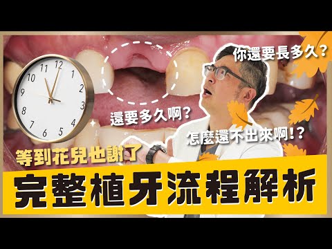 【植牙 #22】看這支影片就懂!少花冤枉錢做好每一步植牙準備!你以為植牙只是種顆牙?其實它是場高難度重建手術!完整植牙流程統統告訴你!【醫師說重點】|【祐民牙醫-隱適美旗艦店】鑽石級楊大為醫師 #植牙
