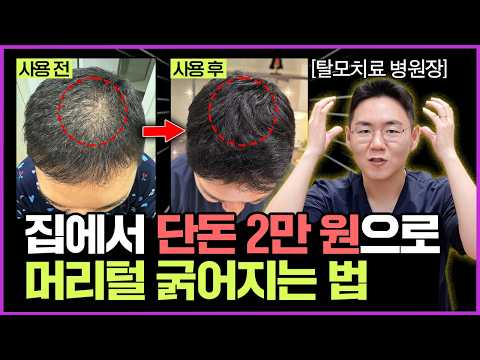 "샴푸, 영양제 아닙니다" 머리카락 얇아지면 '이것'부터 하세요! 단 돈 2만 원으로 수술없이 머리카락 굵어지는 가장 쉬운 방법!