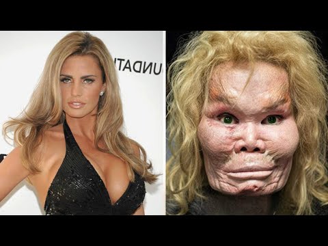 20 Celebrity Beauty Surgeries That Ended in Tragedy