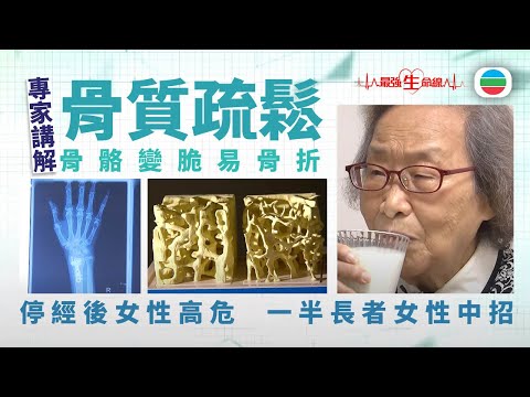 最強生命線|骨質疏鬆:停經後女性高危 一半長者女性中招 (繁 / 簡字幕)|醫療|治療||無綫新聞|TVB News