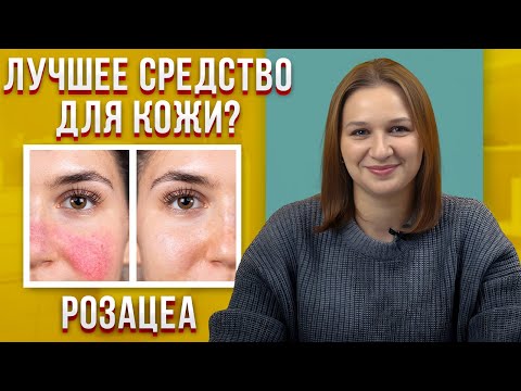 The Best Way to GET RID of Rosacea / Dermatologist's Advice on How to Treat Rosacea