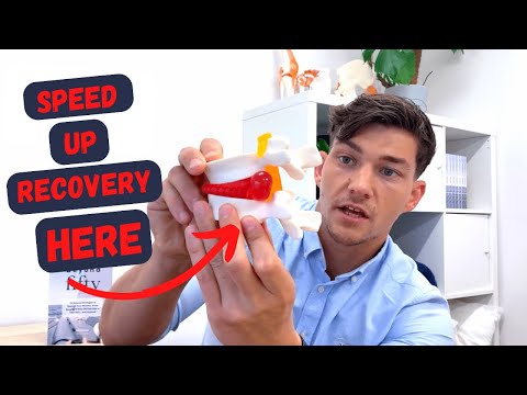 8 Ways to SPEED UP Disc Bulge Recovery Time!