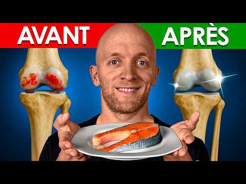 TOP 10 ANTI-ARTHROSIS FOODS