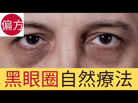 黑眼圈自然療法|徹底改善三招