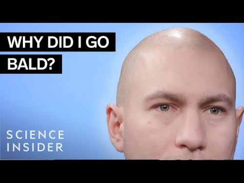Why Some Men Go Bald