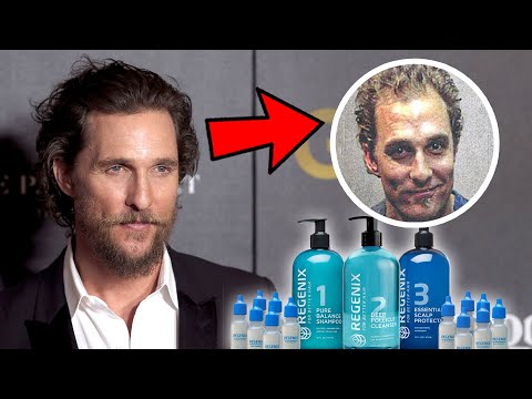 Matthew McConaughey Dedicates His Hair Loss Reversal To THIS "MIRACLE PRODUCT"