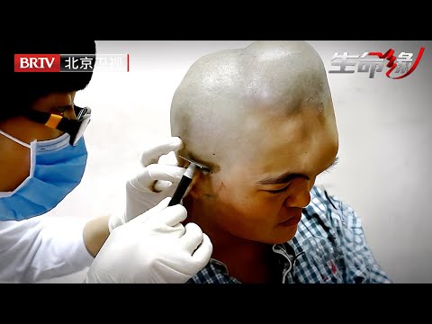 26岁女子患肿瘤20年,全家人竟毫不知情,剃光头发后震惊医生【生命缘第2季】