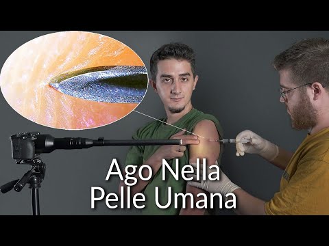 Ingrandimento di Oggetti di Uso Quotidiano (test della Fotocamera Macro 1000x)