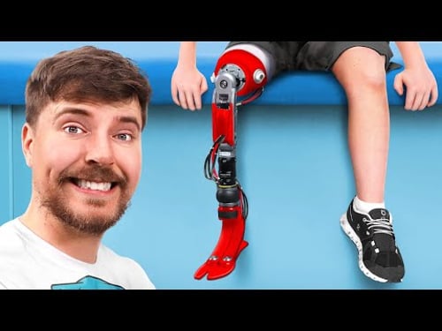 We Helped 2000 People Get New Legs