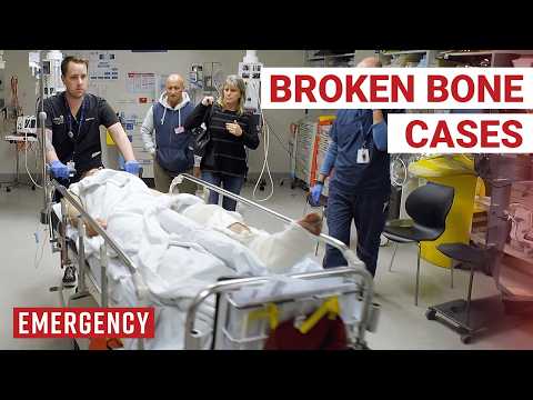 The Worst Fractures Ever Seen In ER!