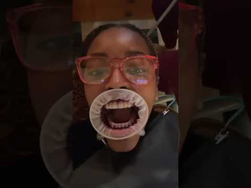 5 star dental service with spa like treatment🤩 #dentist #toronto #luxury #pastedental