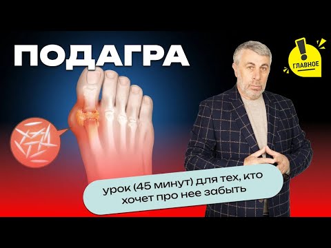ПОДАГРА | Урок (45 минут) для тех, кто хочет про нее забыть