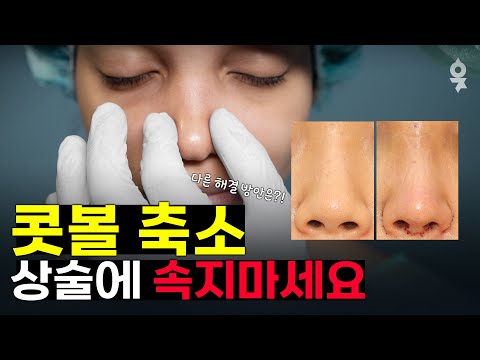 콧볼 축소 없이 콧볼이 날씬해지는 방법?! 콧볼 축소 함부로 하지 마세요🙅♂️
