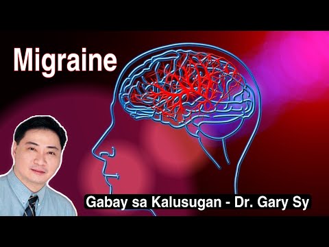 Migraine (One Sided Headache) - Dr. Gary Sy