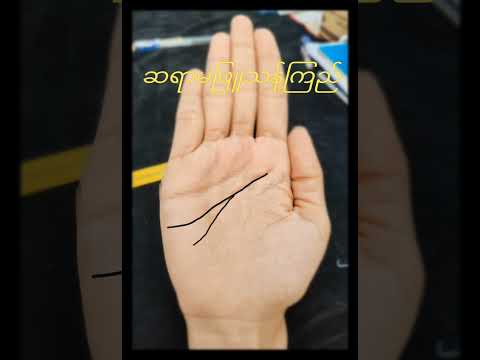 ဦခေါင်းနှစ်လုံးနှင့်လူသား