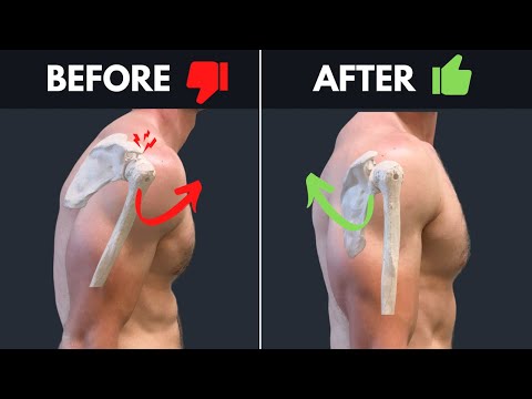 How To Un-Fu*k Your Shoulder - Fix Chronic Aching, Pinching, & Rotator Cuff Weakness
