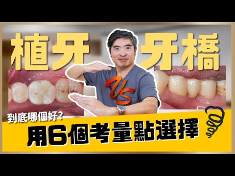 【植牙 #18】植牙vs牙橋怎麼選?連醫師都說很少人知道的決策關鍵!從時間、年紀到預算一次解析!6大關鍵幫你一次搞懂!【醫師來計較】|【祐民牙醫-隱適美旗艦店】鑽石級楊大為醫師 #植牙 #植牙手術