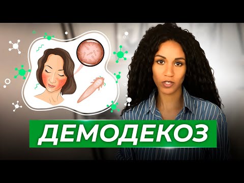 ДЕМОДЕКС // ДЕМОДЕКОЗ: как и чем лечить?