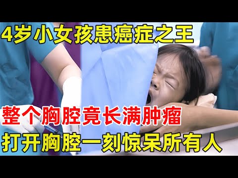 2024最新|4岁小女孩患癌症之王!整个胸腔长满肿瘤,打开胸腔一刻在场医生震惊了【生命之路】