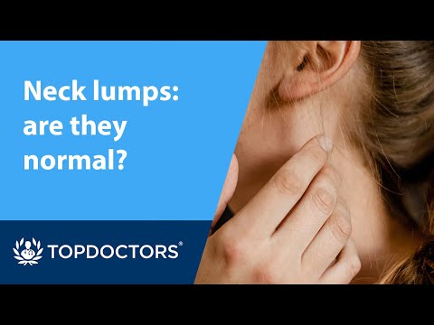 Neck lumps: are they normal?