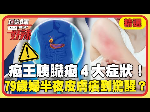 「癌王」胰臟癌4大症狀!79歲老婦半夜「皮膚癢」到驚醒?半年內瘦10kg.眼白呈淡黃色竟長2.5cm惡性腫瘤!【#醫師好辣】精選