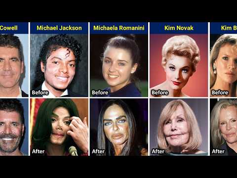 50+ Shocking Celebrity Plastic Surgery Disasters | Before and After