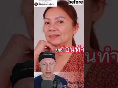 Why Does This Facelift Look Intimidating? | Plastic Surgeon Reacts